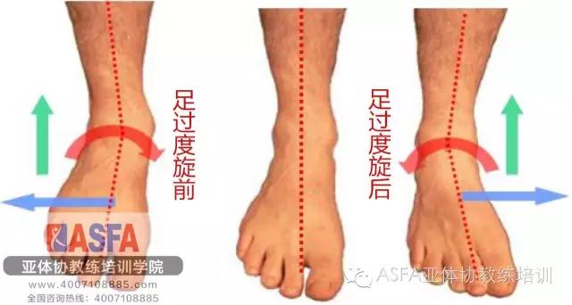 【asfa亚体协微信培训】扁平足,高足弓,你的脚正常吗?